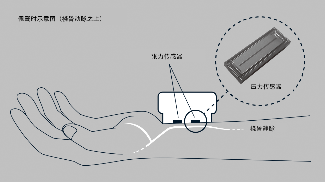 手首に機器をつけるだけで1拍ごとの血圧を測定できる、オムロン独自の圧力センサー